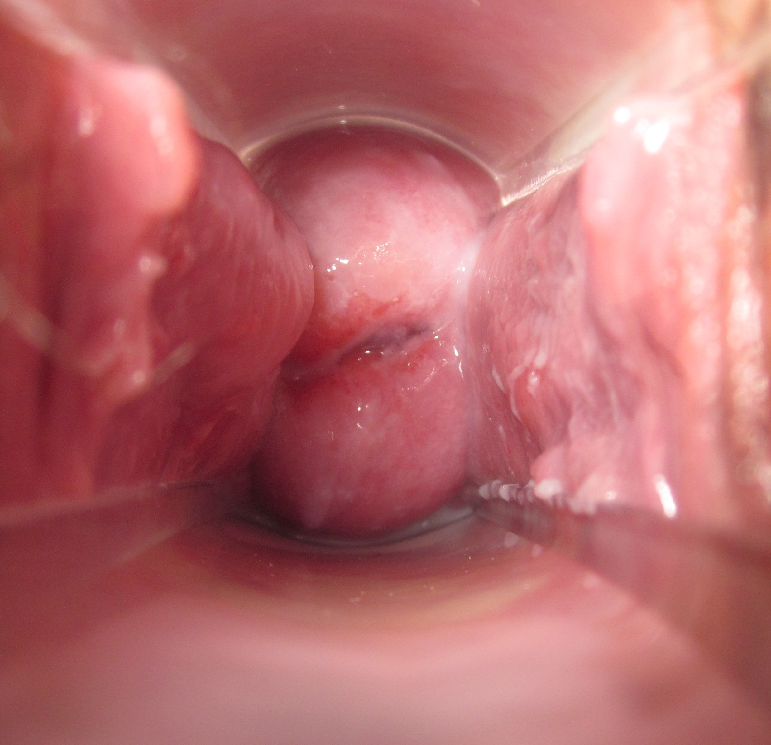 Picture Of Beautiful Vagina Image 170785