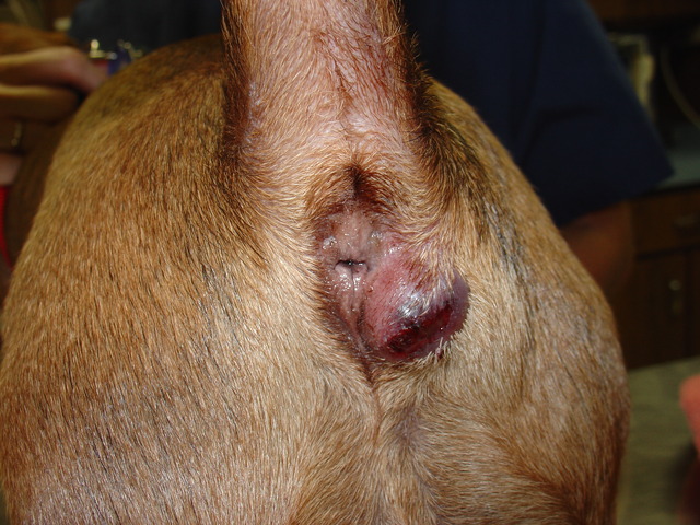 anal pics anal wikipedia commons gland abscess
