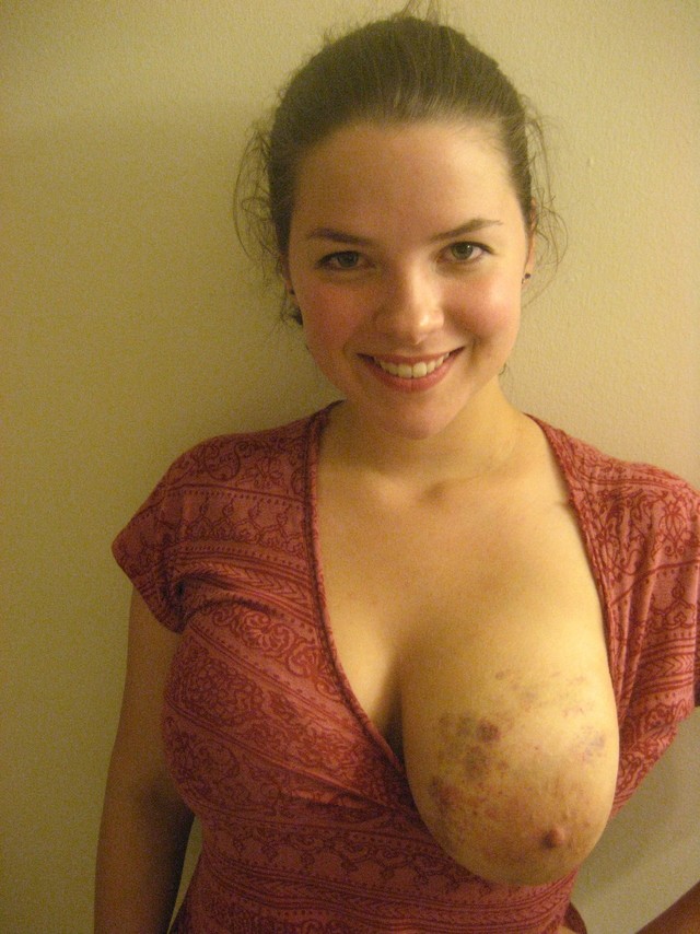 free porn girl girl girl slave bruised