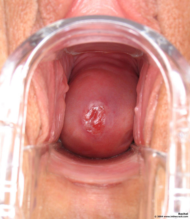 vagina pictures closeup photos rachel cervix