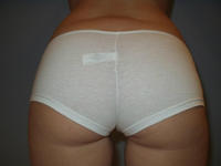 ass panties xxx oitwcqaa large