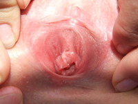 close up pic of a vagina dev