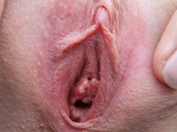 close up pic of a vagina dev