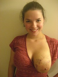 free porn girl girl bruised slave girl