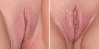 wet vulva pictures media wet vulva pictures