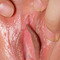 close up pic of a vagina